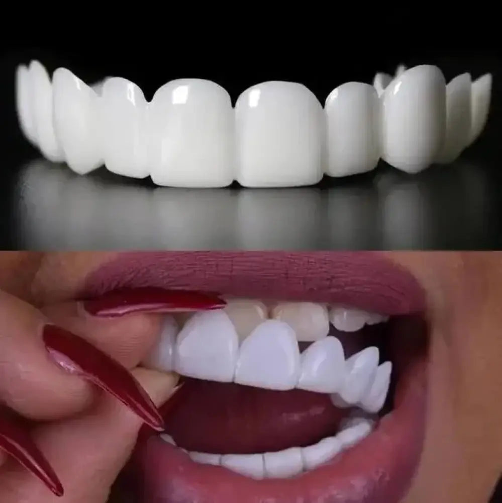 Snap On Smile Veneers (Upper & Lower Included)