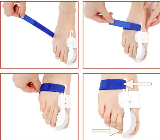 Toe Correction Brace