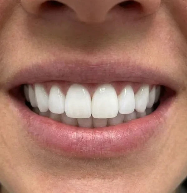 After - Emily