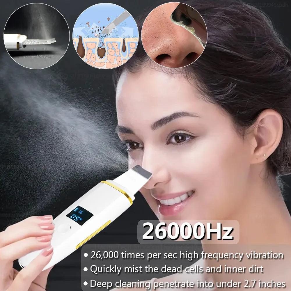 Ultrasonic Skin Scrubber Blackhead Peeling Remover