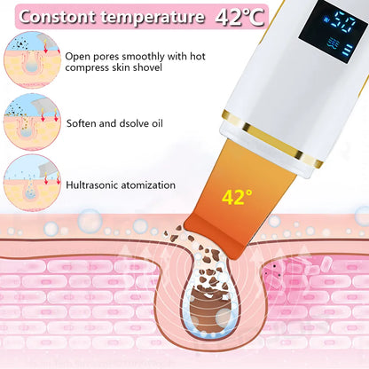 Ultrasonic Skin Scrubber Blackhead Peeling Remover