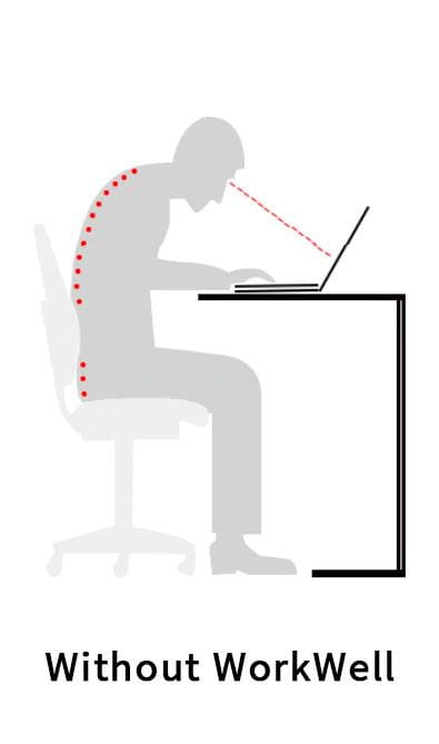 Poor posture without laptop stand causing neck strain