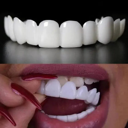 Snap On Smile Veneers (Upper & Lower Included)