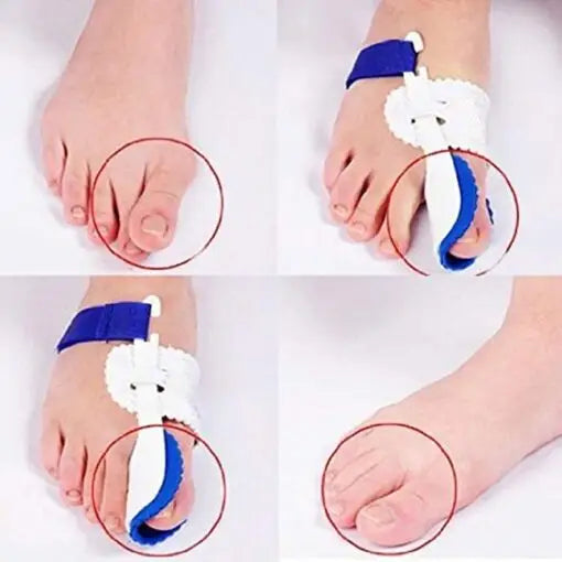Toe Correction Brace