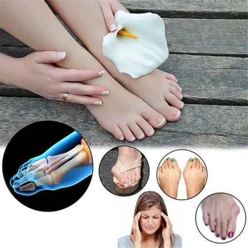 Toe Correction Brace