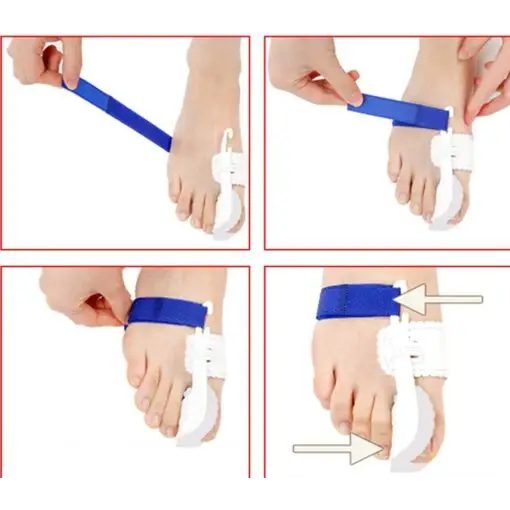 Toe Correction Brace