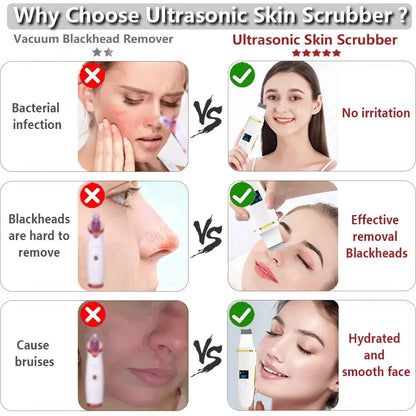 Ultrasonic Skin Scrubber Blackhead Peeling Remover