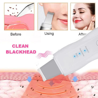 Ultrasonic Skin Scrubber – 3 Modes, Deep Cleanse & Lift