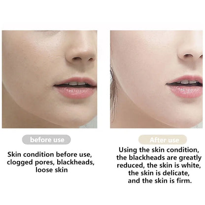 Ultrasonic Skin Scrubber – 3 Modes, Deep Cleanse & Lift
