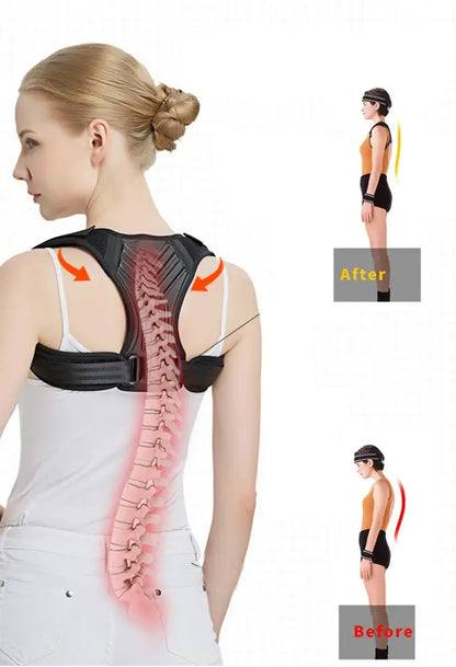 Unisex Adjustable Back Posture Corrector – M & L, Breathable