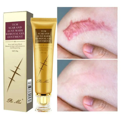 Youthful Scar Remover Cream - Ninjanew