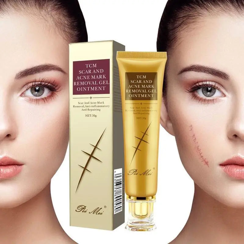 Youthful Scar Remover Cream