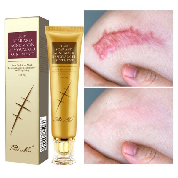 Youthful Scar Remover Cream - Image 6