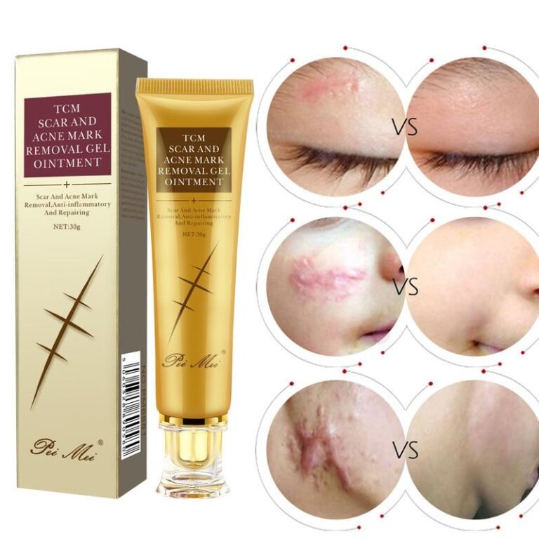 Youthful Scar Remover Cream