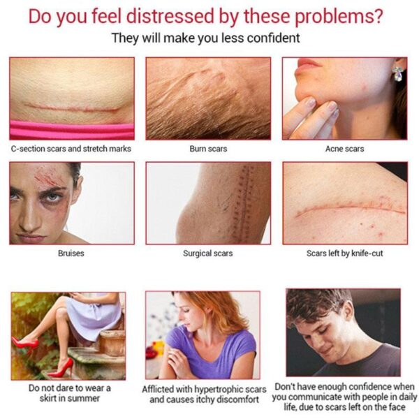 Youthful Scar Remover Cream - Image 2