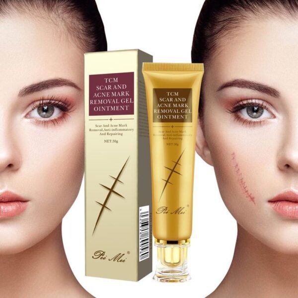 Youthful Scar Remover Cream - Image 5