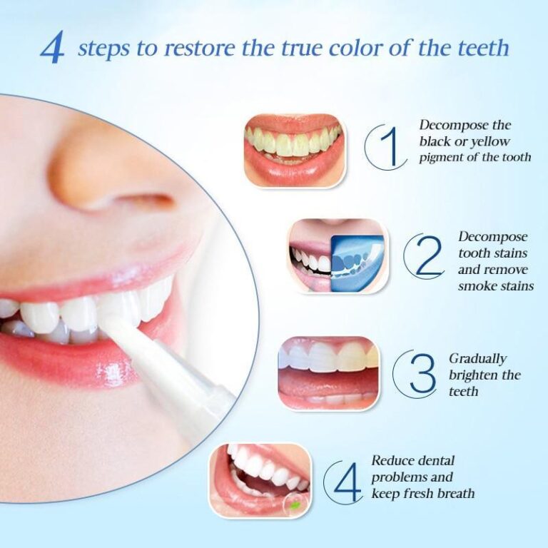 Flawless Teeth Whitening Pen - Image 2